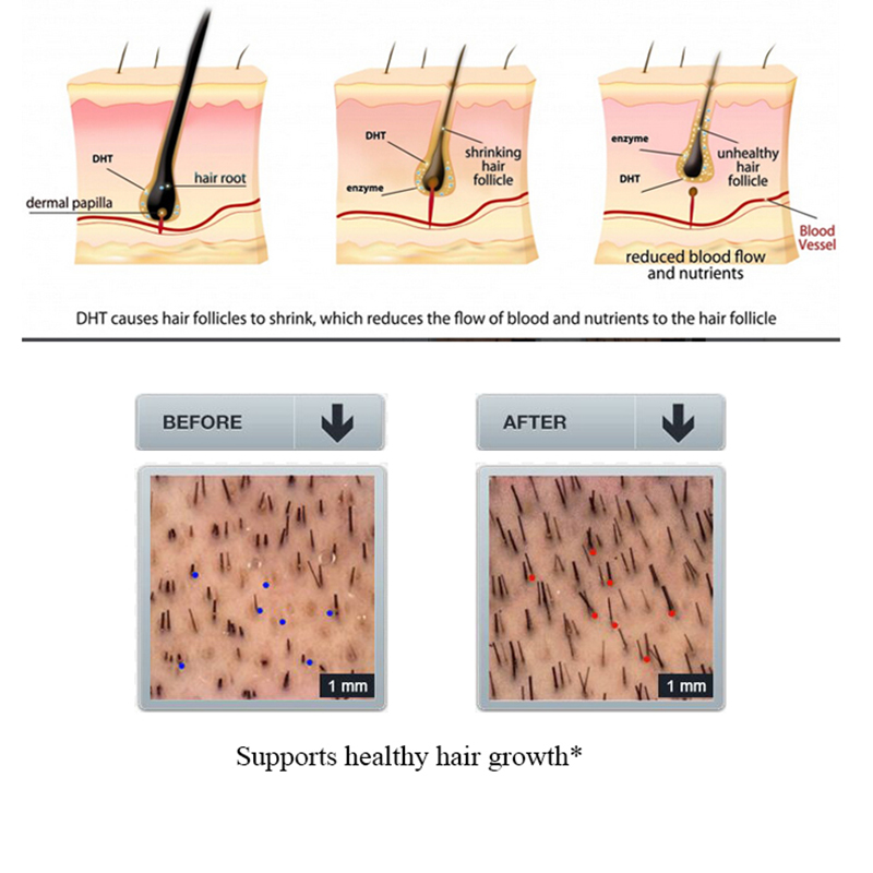 Purc gengibre perda de cabelo  - Licorice Root Sticks avaliação e preço